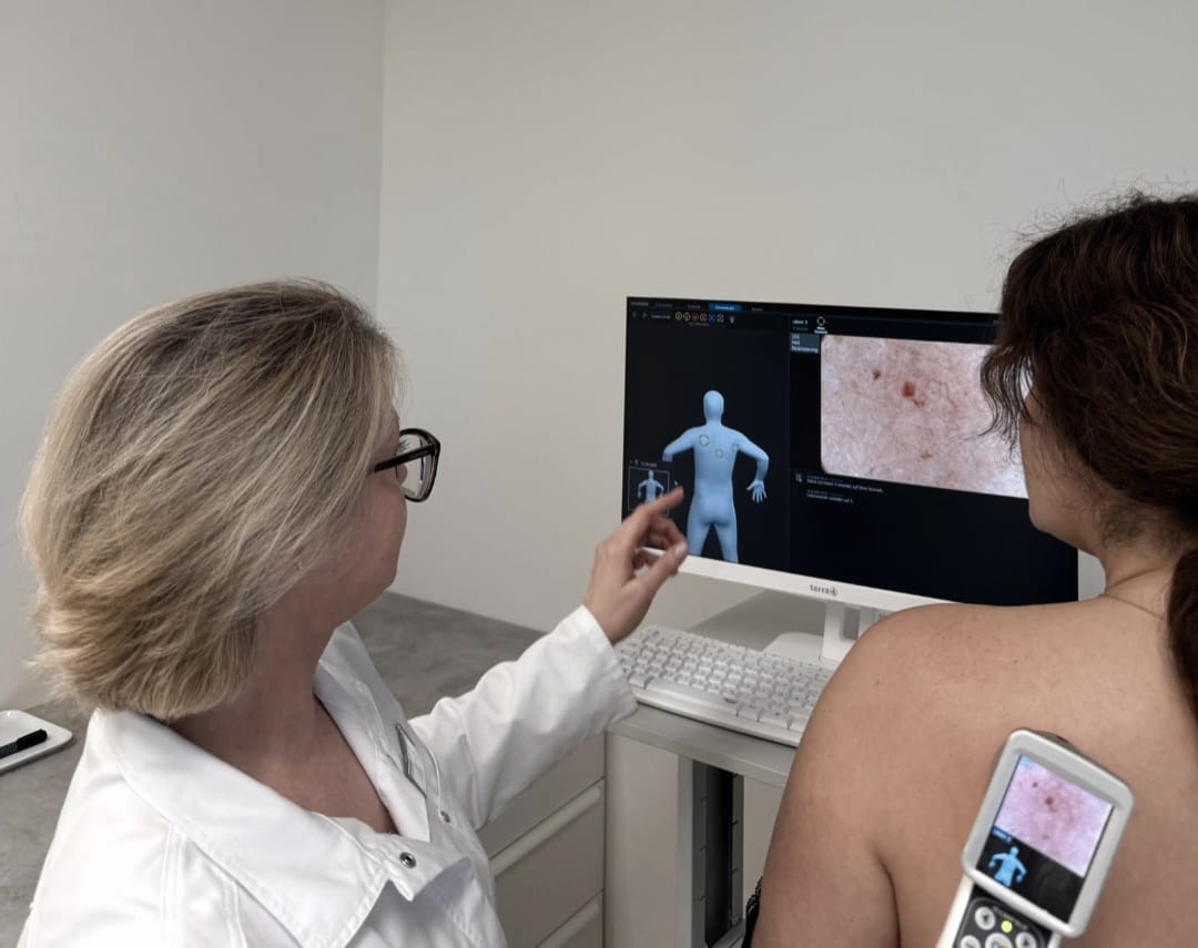 Videodermatoskopie